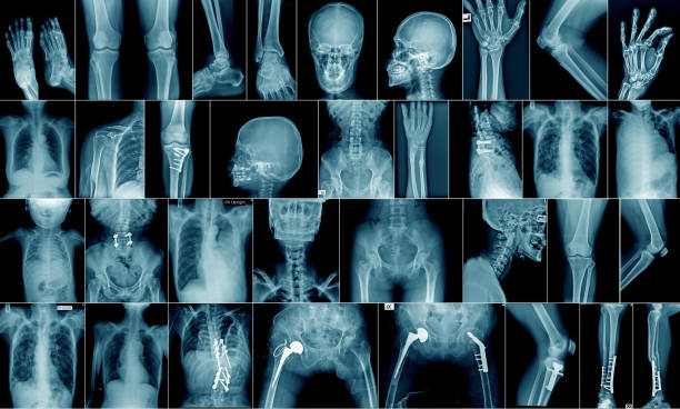 Medical scans